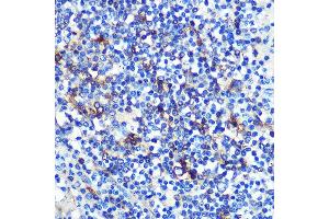 Immunohistochemistry of paraffin-embedded human spleen using HLA-DRA Rabbit mAb (ABIN7267758) at dilution of 1:100 (40x lens). (HLA-DRA Antikörper)