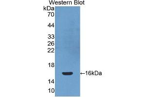 Western blot analysis of the recombinant protein. (PDGFC Antikörper  (AA 235-345))