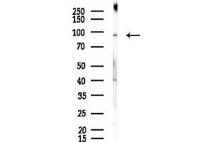 anti-RAS P21 Protein Activator 3 (RASA3) (Internal Region) antibody