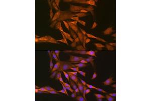 Immunofluorescence analysis of NIH-3T3 cells using Thioredoxin 1 (Trx1/Thioredoxin 1 (Trx1/TXN)) Rabbit pAb (ABIN6133955, ABIN6149720, ABIN6149722 and ABIN6223553) at dilution of 1:100 (40x lens). (TXN Antikörper  (C-Term))