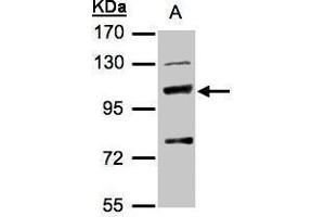 WB Image Sample(30 μg of whole cell lysate) A:Hep G2, 7. (MANBA Antikörper)