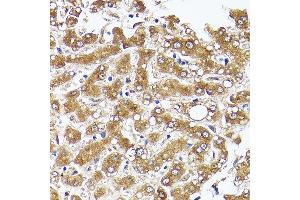 Immunohistochemistry (IHC) image for anti-Acetyl-CoA Carboxylase alpha (ACACA) antibody (ABIN7265370)