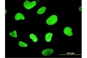 Image no. 2 for anti-High Mobility Group Box 1 (HMGB1) (AA 1-216) antibody (ABIN466031) (HMGB1 Antikörper  (AA 1-216))
