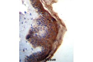 Immunohistochemistry (IHC) image for anti-Interleukin 1 delta (FIL1d) antibody (ABIN2996646) (FIL1d Antikörper)