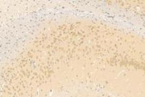 Immunohistochemistry analysis of paraffin-embedded mouse brain using,Neuroligin 3 (ABIN7074816) at dilution of 1: 1200 (Neuroligin 3 Antikörper)