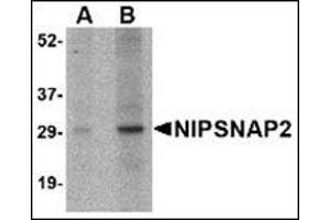 Western blot analysis of NIPSNAP2 in human skeletal muscle tissue lysate with this product at (A) 1 and (B) 2 μg/ml. (GBAS Antikörper  (Center))