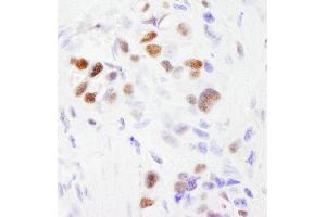 anti-Splicing Factor 3b, Subunit 2, 145kDa (SF3B2) (AA 825-872) antibody