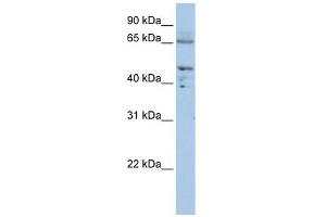 DLAT antibody used at 1 ug/ml to detect target protein. (DLAT Antikörper  (C-Term))