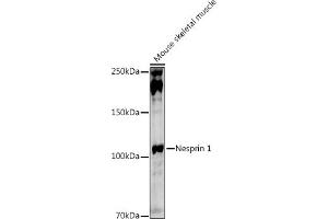 Western blot analysis of extracts of Mouse skeletal muscle, using Nesprin 1 antibody (ABIN7270520) at 1:1000 dilution. (SYNE1 Antikörper)