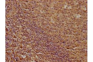 IHC image of ABIN7139916 diluted at 1:100 and staining in paraffin-embedded human tonsil tissue performed on a Leica BondTM system. (LPAR5 Antikörper  (AA 310-326))