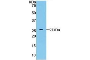 Detection of Recombinant FGFRL1, Human using Polyclonal Antibody to Fibroblast Growth Factor Receptor Like Protein 1 (FGFRL1) (FGFRL1 Antikörper  (AA 168-378))