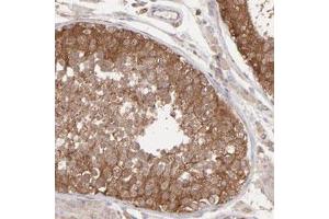 Immunohistochemical staining (Formalin-fixed paraffin-embedded sections) of human testis with MAPRE1 polyclonal antibody  shows strong cytoplasmic positivity in cells of seminiferous ducts. (MAPRE1 Antikörper)