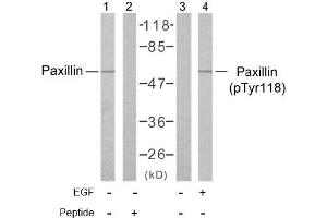 Image no. 1 for anti-Paxillin (PXN) (pTyr118) antibody (ABIN196777) (Paxillin Antikörper  (pTyr118))
