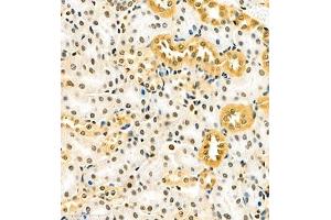 Immunohistochemistry (Paraffin-embedded Sections) (IHC (p)) image for anti-RNA Binding Motif Protein 45 (RBM45) antibody (ABIN7075477)