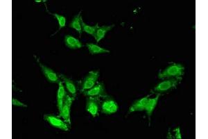 Immunofluorescent analysis of Hela cells using ABIN7147724 at dilution of 1:100 and Alexa Fluor 488-congugated AffiniPure Goat Anti-Rabbit IgG(H+L) (CHD5 Antikörper  (AA 1600-1699))