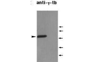 Western Blotting (WB) image for anti-Tubulin, gamma 1 (TUBG1) (C-Term) antibody (ABIN2451983) (TUBG1 Antikörper  (C-Term))