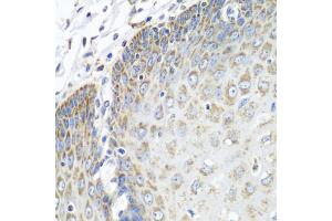 Immunohistochemistry of paraffin-embedded human esophagus using TMOD3 antibody (ABIN5972684) at dilution of 1/100 (40x lens). (TMOD3 Antikörper)
