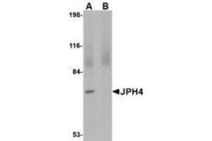 Image no. 1 for anti-Junctophilin 4 (JPH4) (C-Term) antibody (ABIN341700)