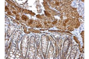 IHC-P Image alpha smooth muscle Actin antibody detects alpha smooth muscle Actin protein at cytosol on mouse colon by immunohistochemical analysis.