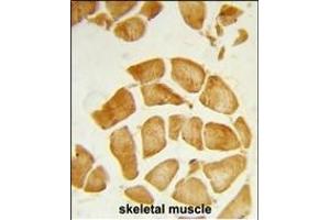 Immunohistochemistry (Paraffin-embedded Sections) (IHC (p)) image for anti-Acidic (Leucine-Rich) Nuclear phosphoprotein 32 Family, Member A (ANP32A) (AA 211-239), (C-Term) antibody (ABIN6243481)