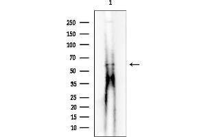 anti-Family with Sequence Similarity 114, Member A2 (FAM114A2) antibody