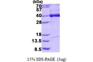 Image no. 1 for TAR DNA Binding Protein (TARDBP) protein (His tag) (ABIN1098222)