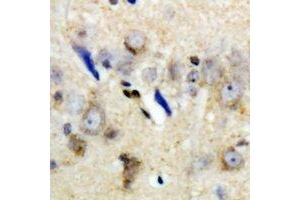 Immunohistochemical analysis of LC3A staining in human brain formalin fixed paraffin embedded tissue section. (MAP1LC3A Antikörper)