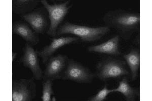 Immunofluorescent staining of HeLa (ATCC CCL-2) cells.