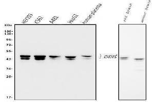 Western blot analysis of hnRNP D/AUF1/HNRNPD using anti-hnRNP D/AUF1/HNRNPD antibody (ABIN7602591).