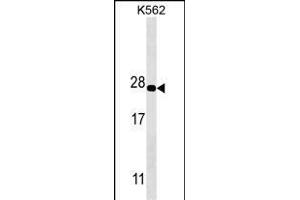 PS Antibody (ABIN1539887 and ABIN2843849) western blot analysis in K562 cell line lysates (35 μg/lane). (PSMA5 Antikörper)