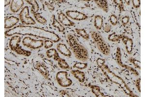 ABIN6261811 and ABIN6272300 at 1/100 staining Human kidney tissue by IHC-P.