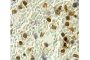Immunohistochemistry (IHC) image for anti-Heparanase (HPSE) (AA 400-543) antibody (ABIN1173465)
