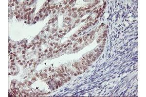 Image no. 3 for anti-Ring Finger Protein 113B (RNF113B) antibody (ABIN1500718) (RNF113B Antikörper)