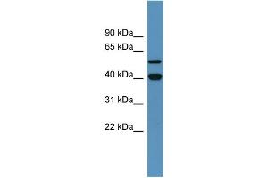 Western Blotting (WB) image for anti-Damage-Specific DNA Binding Protein 2, 48kDa (DDB2) (C-Term) antibody (ABIN2788357) (DDB2 Antikörper  (C-Term))