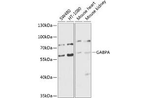 Western blot analysis of extracts of various cell lines, using GABPA antibody (ABIN6127940, ABIN6140889, ABIN6140892 and ABIN6224475) at 1:1000 dilution. (GABPA Antikörper  (AA 1-260))