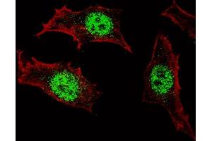 Fluorescent confocal image of HeLa cells stained with (ABIN389189 and ABIN2839352) KLF4 antibody. (KLF4 Antikörper)