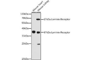 Western blot analysis of extracts of various cell lines, using 67 kDa Laminin Receptor antibody (ABIN6128199, ABIN6147247, ABIN6147248 and ABIN6224857) at 1:3000 dilution. (RPSA/Laminin Receptor Antikörper  (AA 1-295))