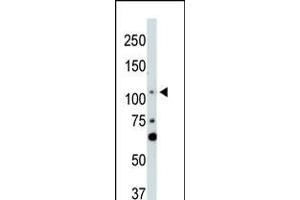 Antibody is used in Western blot to detect LATS2 in NIH-3T3 cell lysate. (LATS2 Antikörper  (AA 228-258))