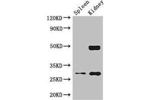 Western Blot Positive WB detected in: Mouse lung tissue, Mouse kidney tissue All lanes: DDAH2 antibody at 2. (DDAH2 Antikörper  (AA 1-285))