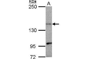 WB Image Sample (30 ug of whole cell lysate) A: HepG2 5% SDS PAGE antibody diluted at 1:500