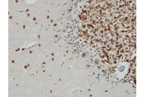 Image no. 2 for anti-Nucleoprotein TPR (TPR) (AA 1-99) antibody (ABIN598986) (TPR Antikörper  (AA 1-99))