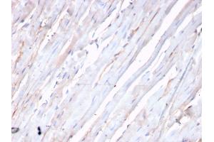 Formalin-fixed, paraffin-embedded human heart stained with N-Cadherin Recombinant Rabbit Monoclonal Antibody (CDH2/3874R). (Rekombinanter N-Cadherin Antikörper)