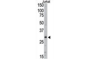 Western Blotting (WB) image for anti-Sirtuin 5 (SIRT5) antibody (ABIN3002566) (SIRT5 Antikörper)