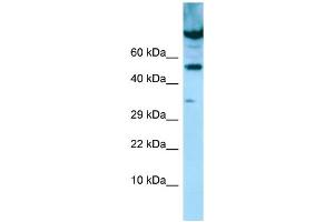 WB Suggested Anti-PDE7A Antibody Titration: 1. (PDE7A Antikörper  (C-Term))
