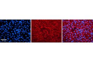 Immunohistochemistry (IHC) image for anti-Potassium Voltage-Gated Channel, Shaw-Related Subfamily, Member 3 (KCNC3) (Middle Region) antibody (ABIN2776169)