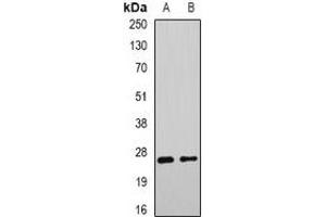 Western blot analysis of DNAJB9 expression in mouse liver (A), rat liver (B) whole cell lysates. (DNAJB9 Antikörper)