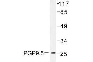 Image no. 2 for anti-Ubiquitin Carboxyl-terminal Esterase L1 (Ubiquitin Thiolesterase) (UCHL1) antibody (ABIN271784) (UCHL1 Antikörper)