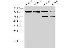 Western Blot analysis of 1)HepG2, 2)Rat brain, 3)Mouse liver, 4)Mouse brain using CD146 Ployclonal Antibody at dilution of 1:500. (MCAM Antikörper)