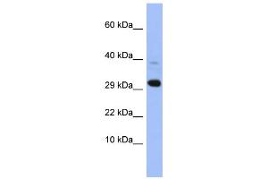 WB Suggested Anti-MRPL47 Antibody Titration: 0. (MRPL47 Antikörper  (Middle Region))