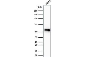 Western Blot Analysis of human HeLa cell lysate using Cytokeratin 7 Monoclonal Antibody (SPM270). (Cytokeratin 7 Antikörper)